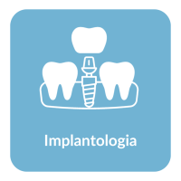 uslugi_implantologia